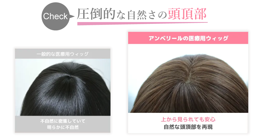 頭頂部の医療用ウィッグ比較