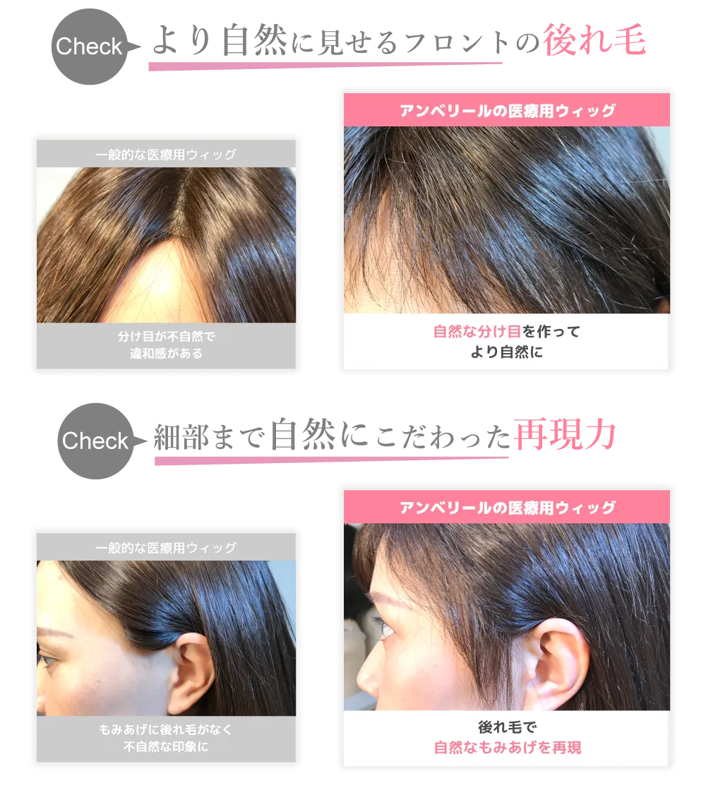 他社とアンベリールの医療用ウィッグ比較