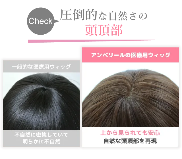 頭頂部の医療用ウィッグ比較