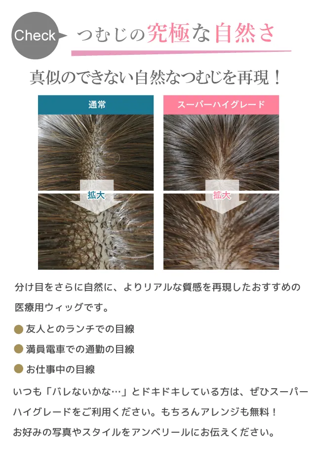 スーパーハイグレードの医療用ウィッグ比較
