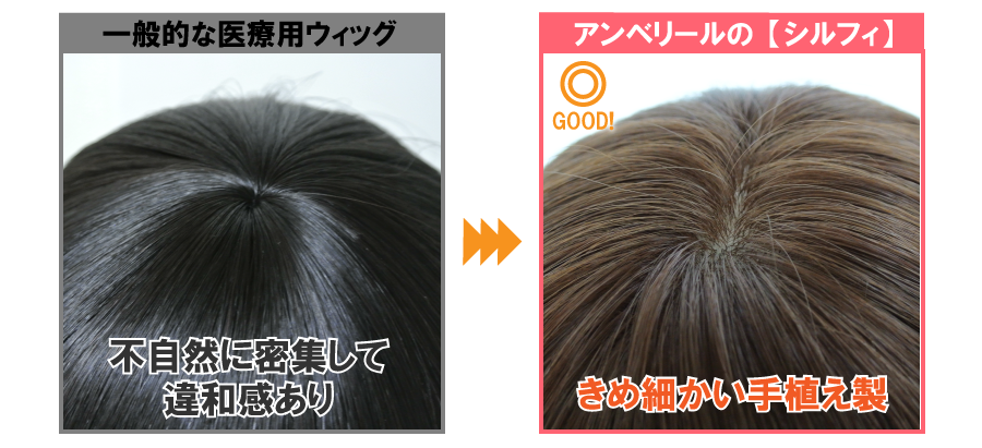 きめ細かい手植え製