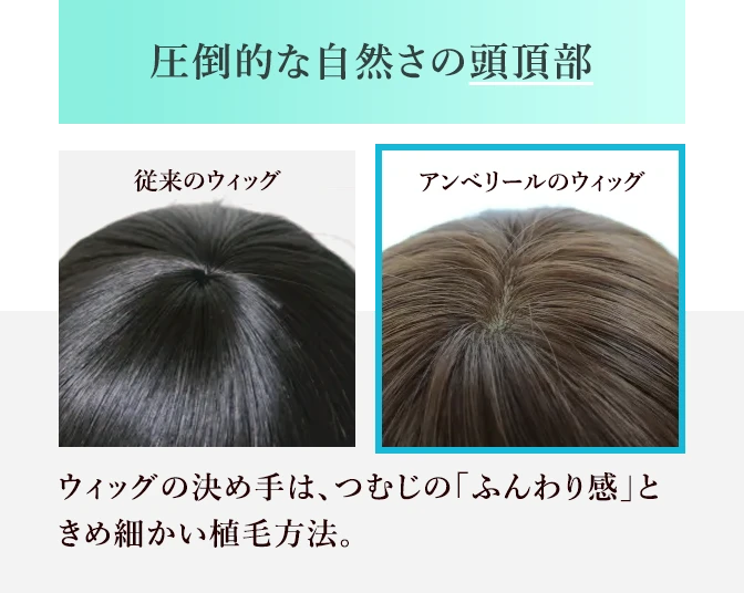 圧倒的な自然さの頭頂部｜医療用ウィッグのアンベリール