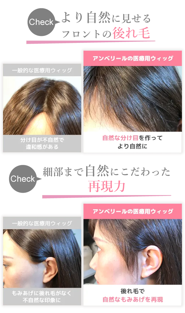 医療用ウィッグは自宅で無料試着がおすすめ｜アンベリール
