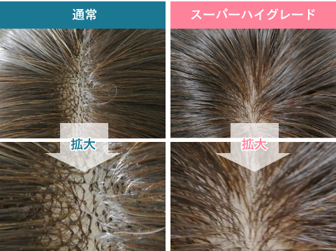 他社との医療用ウィッグ比較